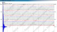 Scossa di terremoto ai Campi Flegrei, magnitudo 2,6