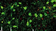Individuato nel cervello il circuito che aiuta a placare l'ansia