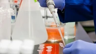 Ail, ogni anno 30mila nuovi tumori del sangue ma passi avanti con la ricerca