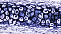 Biomateriali 'smart' e staminali rigenerano le articolazioni