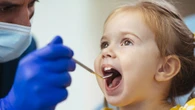Bimbi under-6 quasi mai dal dentista, prevenzione 'Cenerentola'