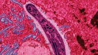 Malaria, trovate le chiavi che aprono le cellule umane al parassita