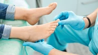 Alluce valgo, una nuova tecnica mini-invasiva migliora tempi di recupero e risultati estetici