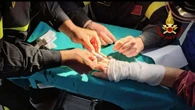 Anelli non si sfilano da mano della paziente, intervento Vvf