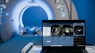 Nuove cure e IA in oncologia, a Milano Conferenza internazionale