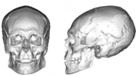 Cranio di 12.000 anni svela pratica intenzionale di deformazione