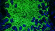 Le diete yo-yo alterano per molto tempo i batteri dell'intestino