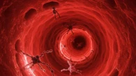 Parkinson, identificatele alterazioni nel sangue