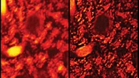 Cellule in super-HD grazie a un bisturi di luce