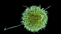 Cellule immunitarie modificate diventano armi contro i tumori