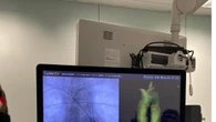 Interventi all'aorta, studi italiani predicono i pazienti ad alto rischio di mortalità