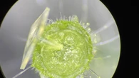 Microaghi di seta per le verdure del futuro, iniettano vitamine