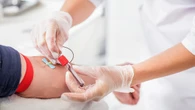 Centro sangue, test ai donatori se sono stati nelle zone con casi di West Nile