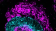 Le cellule tumorali si accendono se schiacciate, è una difesa
