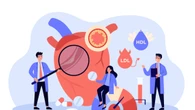 Per 4 italiani su 10 almeno 3 fattori di rischio cardiovascolare