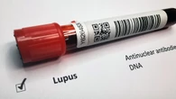 Lupus, diagnosi precoce e nuovi farmaci possono 'addomesticarlo'