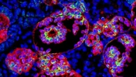 Organoidi di rene per capire le cause della malattia renale cronica