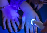 E' vero che in italia c'è un'allerta per la diffusione della scabbia?