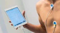 Arresto cardiaco improvviso nei giovani, dna e cicatrici cuore le cause finora ignote