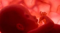 Intervento in utero 'Robin Hood' aiuta sopravvivenza gemelli
