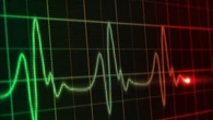 Obesità, la molecola semaglutide previene morte per infarto e ictus
