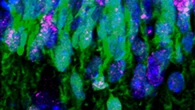 Il Dna è regolarmente rotto e riparato quando il cervello si forma