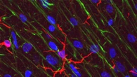Fra i 50 e i 75 anni il cervello cambia, perde cellule immunitarie