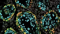 Dalle cellule staminali i primi spermatozoi umani coltivati in laboratorio