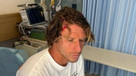 Surf: a Bali incidente sul reef per Ghiara, operazione e 24 punti in testa