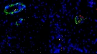 Organoidi di vasi sanguigni, sul cuore come cerotti