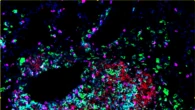 Identificate le cellule che costruiscono avamposti anticancro