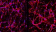 Retina, cellule vascolari ottenute in laboratorio per nuove terapie