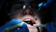 'Troppi posti a odontoiatria', dentisti scrivono a Bernini