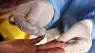 Brevettato a Singapore il primo test multi-virus