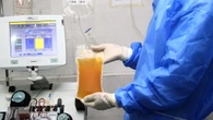 Nel 2025 raccolte in Italia 900 tonnellate di plasma, lontani dall'autosufficienza
