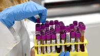 Oltre 500mila persone in Italia con tumori sangue, 30mila l'anno