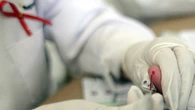 Hiv, primo via libera in Ue a farmaco che protegge dal contagio per 6 mesi