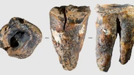 I Neanderthal curavano le carie con trapani di pietra