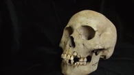Le più antiche tracce della peste risalgono a 5.500 anni fa