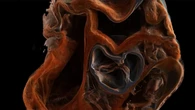Nel 2027 la prima scansione 3D del corpo umano VIDEO
