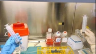 A Torino una ricerca su nuove strategie contro i sarcomi ossei pediatrici