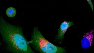 Oltre 1.700 nuove proteine nascoste nel 'proteoma oscuro'