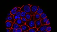 Tumore al pancreas, trovata la proteina che lo rende resistente ai farmaci