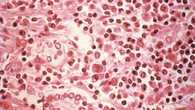 Così l'hantavirus si annida nell'organismo