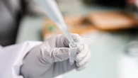 Tumore ovarico, nuovo farmaco per le pazienti non idonee alla chemioterapia