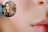 Dermatologista esclarece dúvidas sobre tratamentos de manchas na pele