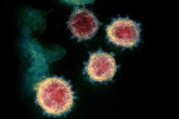 Humanidade viveu epidemia de coronavírus há 20 mil anos, diz pesquisa