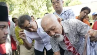 Kenali Ciri-Ciri Kusta, Segera Obati agar Bisa Sembuh Total