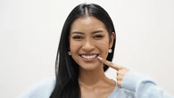 Puteri Indonesia 2026 Agnes Rahajeng Ungkap Alasan Pasang Veneer Gigi, Bukan Semata Esteti...