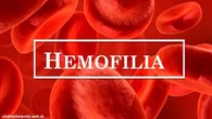 Hari Hemofilia Sedunia: Mengenal Penyebab dan Gejalanya